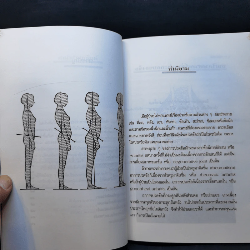 โรคปวดข้อ (Orthopaedics) - ศาสตราจารย์ นายแพทย์ ประดิษฐ์ ตันสุรัต รูปที่ 10