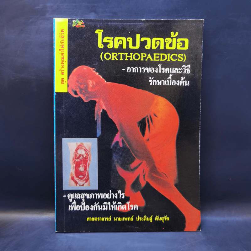 โรคปวดข้อ (Orthopaedics) - ศาสตราจารย์ นายแพทย์ ประดิษฐ์ ตันสุรัต รูปที่ 1