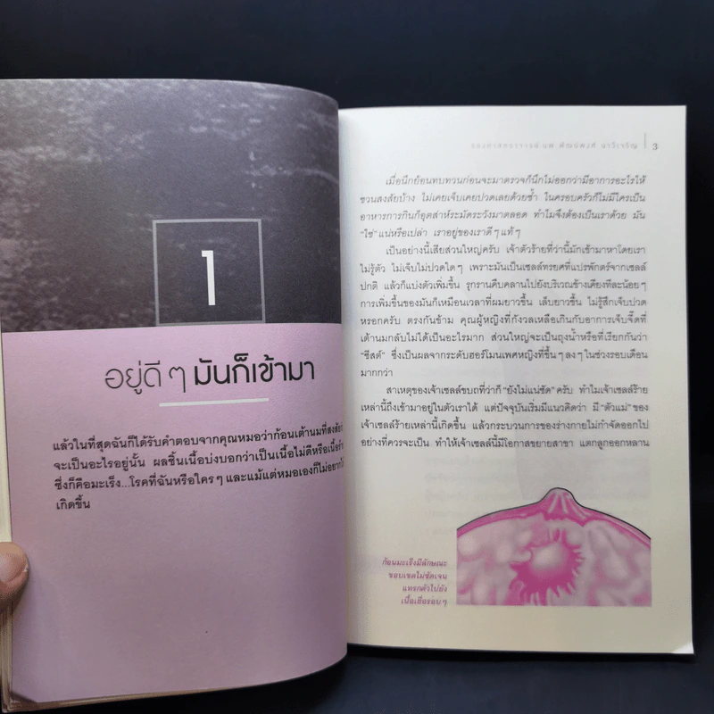 มะเร็งเต้านม เจาะลึกวิธีวินิจฉัยและแผนการรักษาทุกขั้นตอน รูปที่ 12