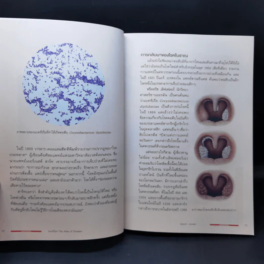 แผนที่โรค : The Atlas of Disease - Sandra Hempel (แซนดรา เฮมเพล) รูปที่ 12