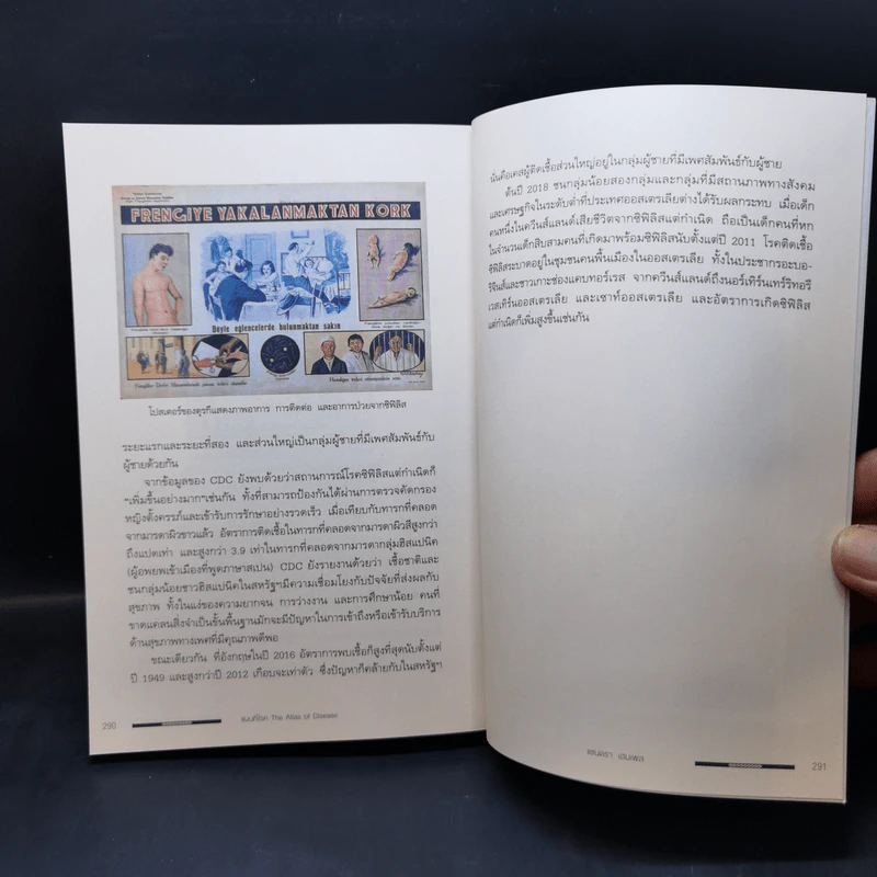 แผนที่โรค : The Atlas of Disease - Sandra Hempel (แซนดรา เฮมเพล) รูปที่ 13