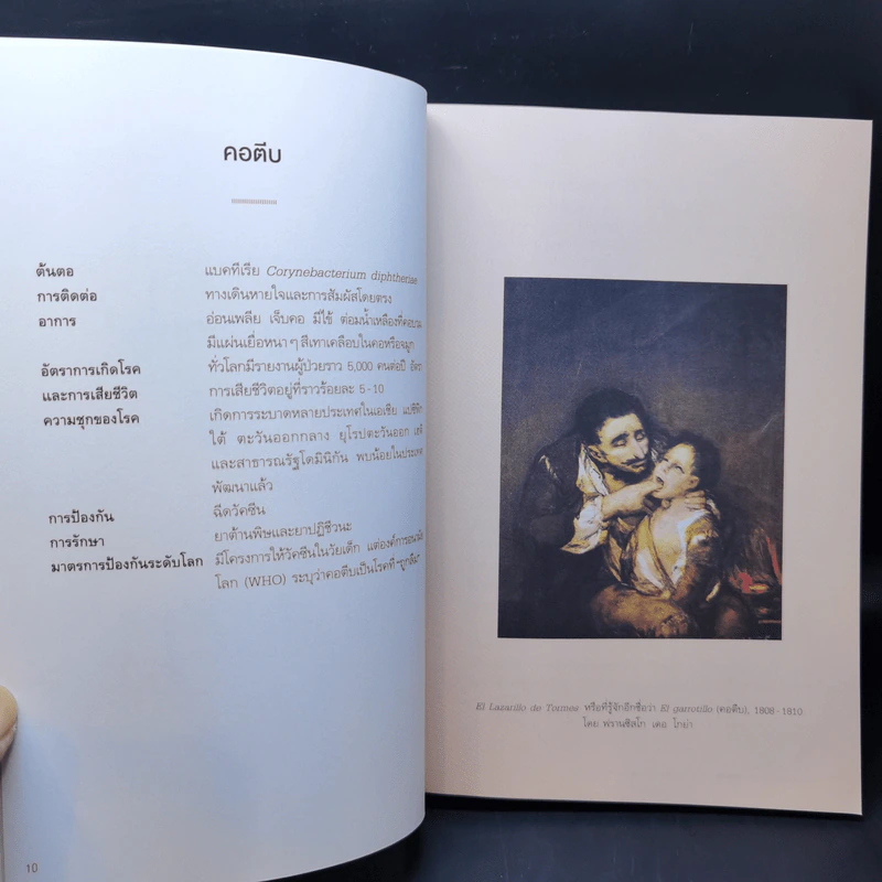 แผนที่โรค : The Atlas of Disease - Sandra Hempel (แซนดรา เฮมเพล) รูปที่ 11