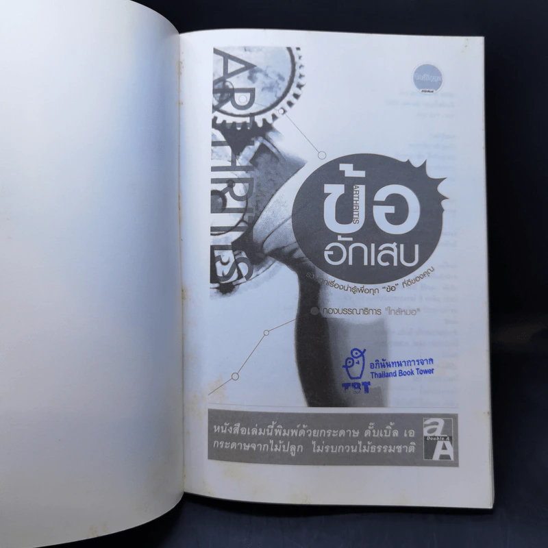 ข้ออักเสบ รวมทุกเรื่องน่ารู้เพื่อทุก ข้อ ที่ดีของคุณ รูปที่ 8