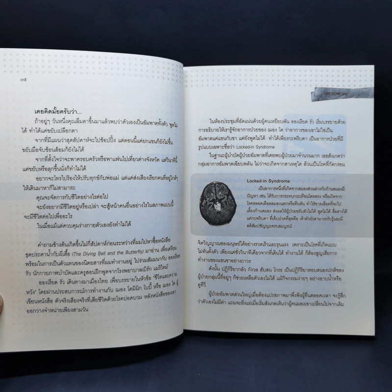 Lifescan มากกว่าที่ตาเห็น - ผมอยู่ข้างหลังคุณ รูปที่ 11