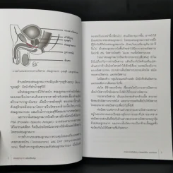 ต่อมลูกหมาก คู่มือซ่อมบำรุงต่อมลูกหมากที่ผู้ชายทุกคนต้องรู้ รูปที่ 15