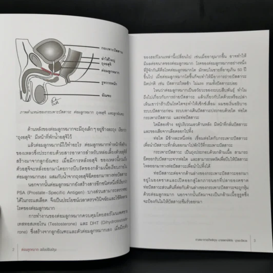 ต่อมลูกหมาก คู่มือซ่อมบำรุงต่อมลูกหมากที่ผู้ชายทุกคนต้องรู้ รูปที่ 15
