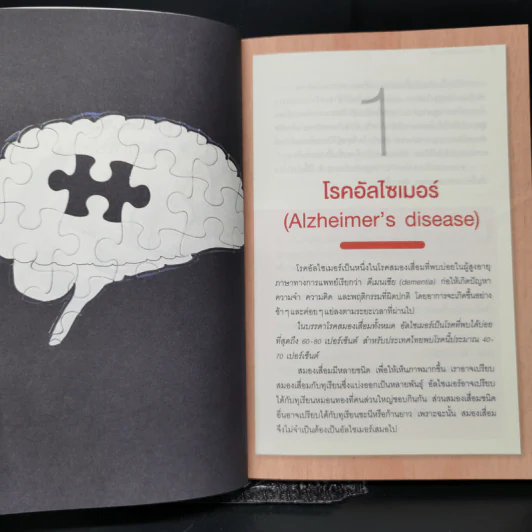 อาหารต้านอัลไซเมอร์ - ศัลยา คงสมบูรณ์เวช รูปที่ 10