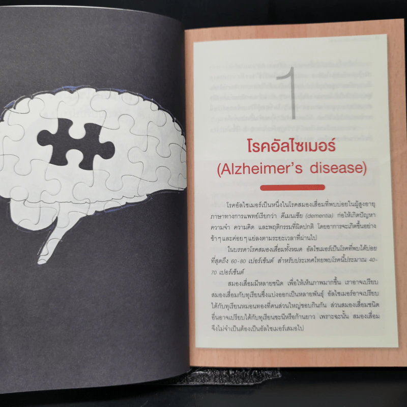 อาหารต้านอัลไซเมอร์ - ศัลยา คงสมบูรณ์เวช รูปที่ 10
