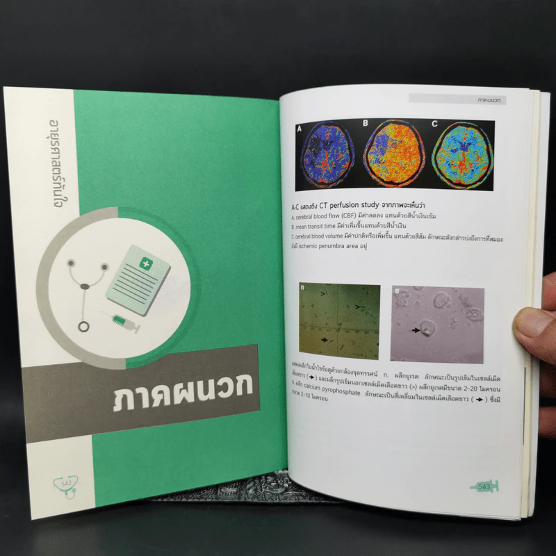 อายุรศาสตร์ทันใจ Survival Guide in Acute Care Medicine รูปที่ 15