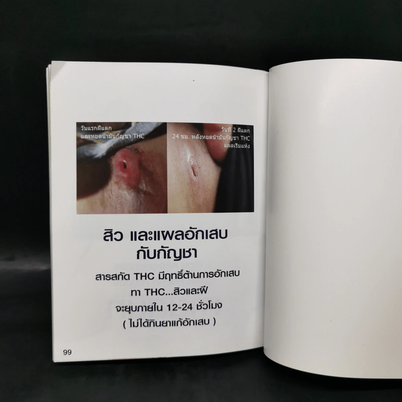 หน้าผาสุขภาพ กับมหัศจรรย์แห่งกัญชา - Dr.Tony Channel รูปที่ 12