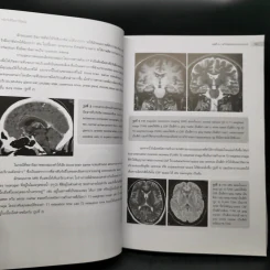 หลักรังสีวิทยาวินิจฉัย Principle of Diagnostic Radiology รูปที่ 13