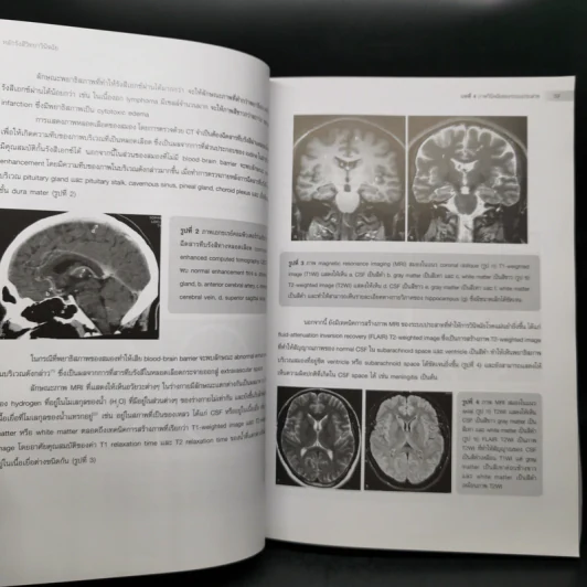 หลักรังสีวิทยาวินิจฉัย Principle of Diagnostic Radiology รูปที่ 13
