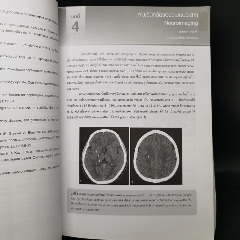 หลักรังสีวิทยาวินิจฉัย Principle of Diagnostic Radiology รูปที่ 12
