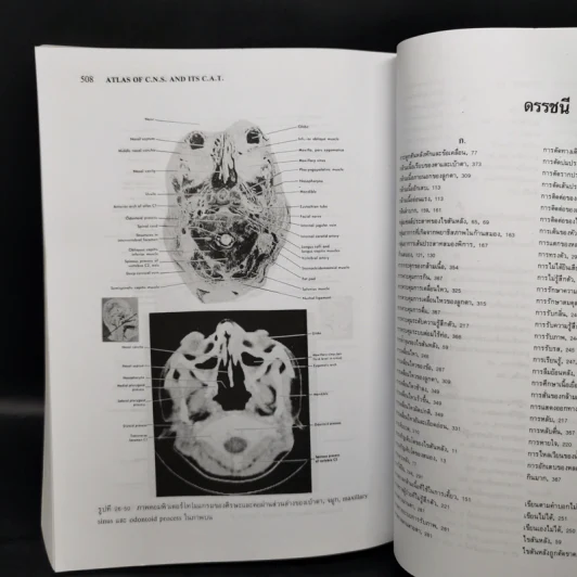 Neuroanatomy ประสาทกายวิภาคศาสตร์ - มีชัย ศรีใส รูปที่ 11