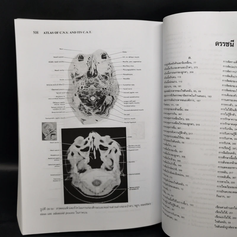 Neuroanatomy ประสาทกายวิภาคศาสตร์ - มีชัย ศรีใส รูปที่ 11