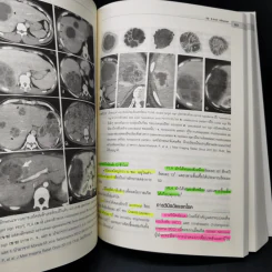 Clinical Practice in Gastroenterology โรคกรดไหลย้อน รูปที่ 14