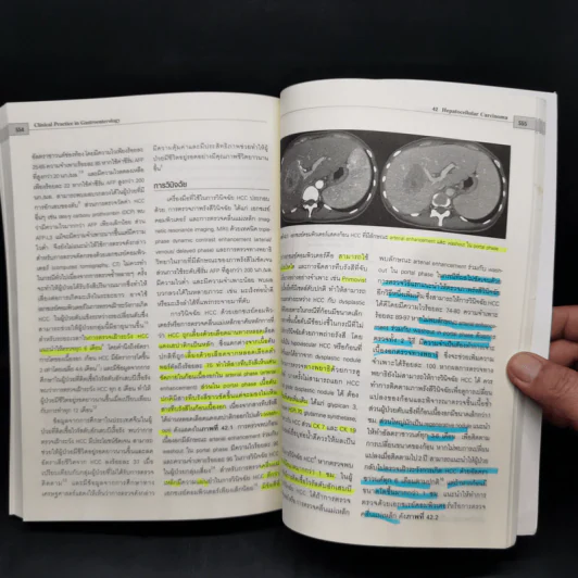 Clinical Practice in Gastroenterology โรคกรดไหลย้อน รูปที่ 18