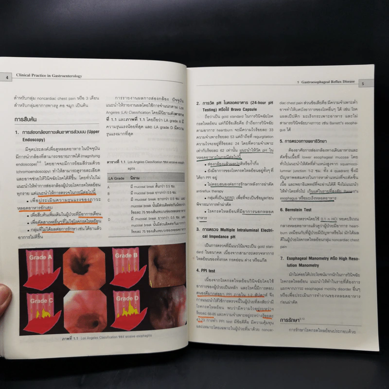 Clinical Practice in Gastroenterology โรคกรดไหลย้อน รูปที่ 13
