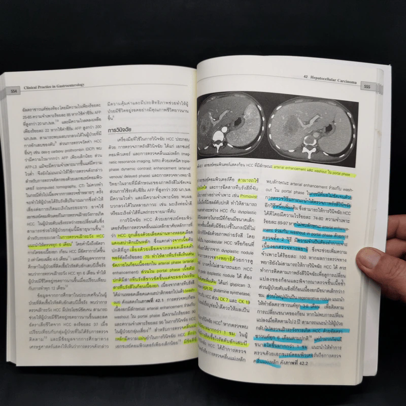 Clinical Practice in Gastroenterology โรคกรดไหลย้อน รูปที่ 18