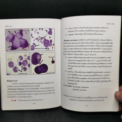 Atlas of Hematology and Body Fluides ภาควิชาพยาธิวิทยาคลินิก รูปที่ 12