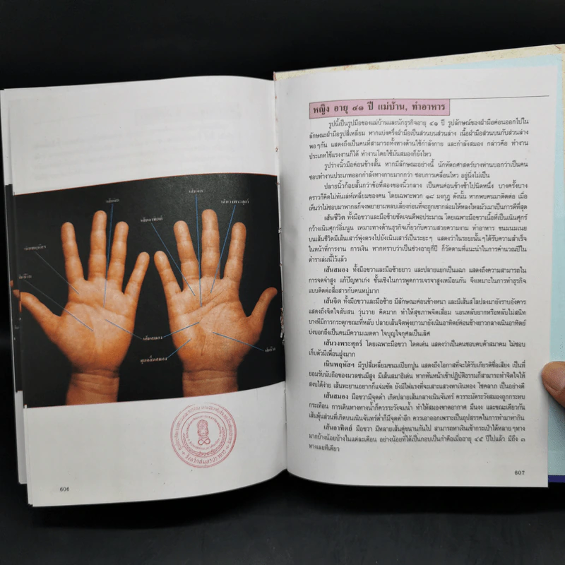 ลายมือ ลายแทงชีวิต - ดร.สุรพล ธีรรัตนพันธุ์ รูปที่ 14