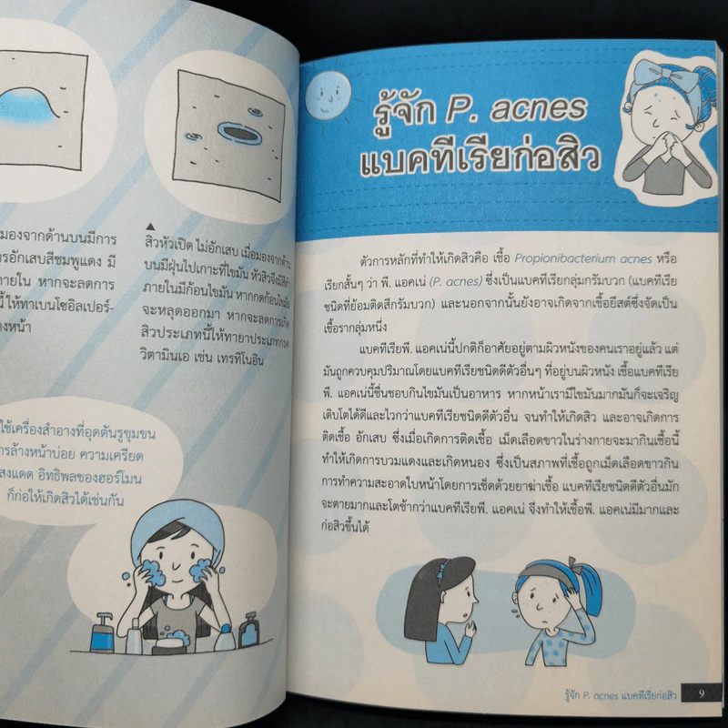 เป็นสิวหายได้ - ดร.เริงฤทธิ์ สัปปพันธ์ รูปที่ 11