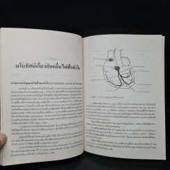 การพยาบาลผู้ป่วยหัวใจเต้นผิดจังหวะ - อรัญญา เชาวลิต รูปที่ 7