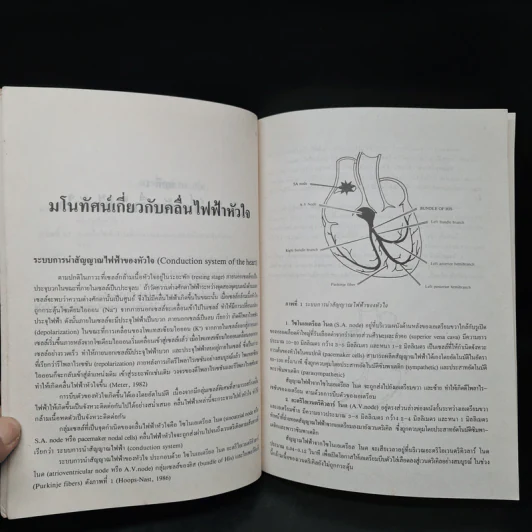 การพยาบาลผู้ป่วยหัวใจเต้นผิดจังหวะ - อรัญญา เชาวลิต รูปที่ 7