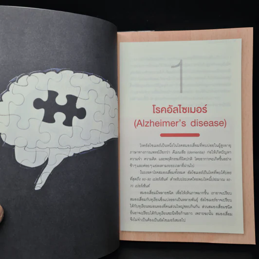 อาหารต้านอัลไซเมอร์ - ศัลยา คงสมบูรณ์เวช รูปที่ 7