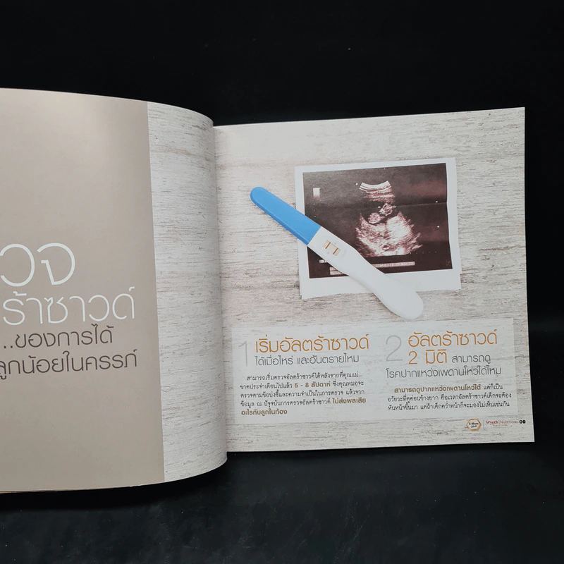 126 สารพันปัญหาแม่ท้อง รูปที่ 7