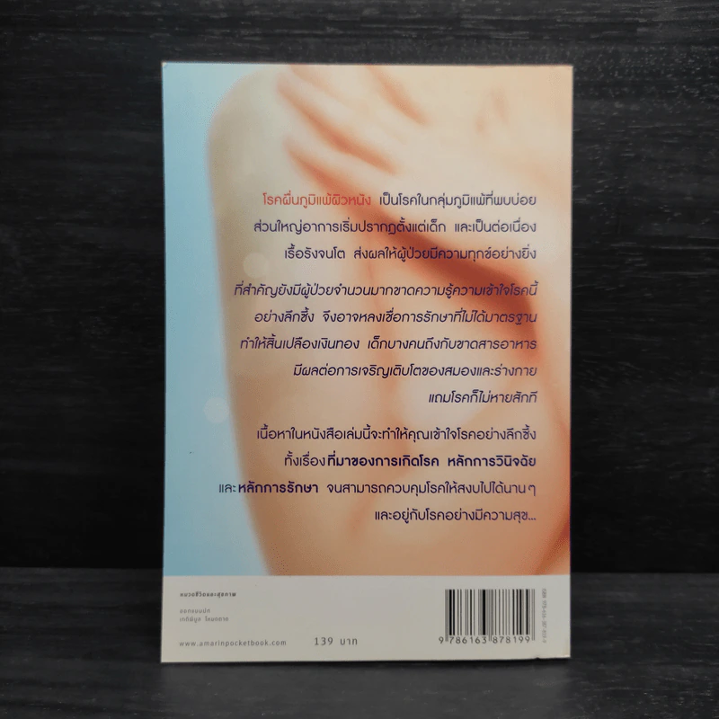 โรคภูมิแพ้ ตอน ภูมิแพ้ผิวหนัง - แพทย์หญิงสิรินันท์ บุญยะลีพรรณ รูปที่ 2