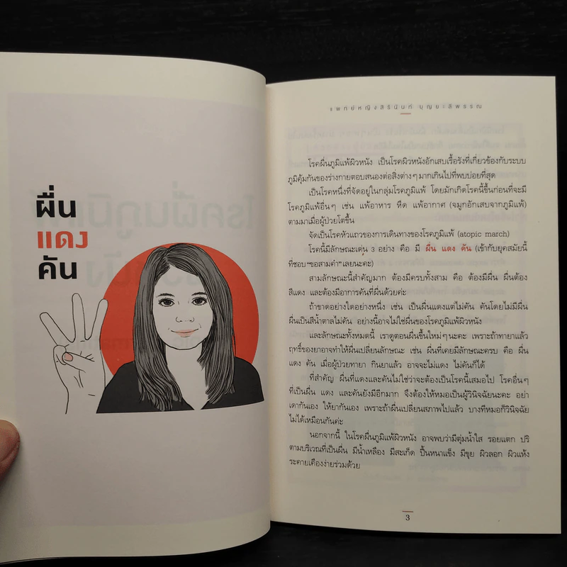 โรคภูมิแพ้ ตอน ภูมิแพ้ผิวหนัง - แพทย์หญิงสิรินันท์ บุญยะลีพรรณ รูปที่ 7