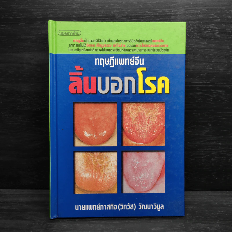 ทฤษฎีแพทย์จีน ลิ้นบอกโรค - นายแพทย์ภาสกิจ (วิทวัส) วัณนาวิบูล รูปที่ 1