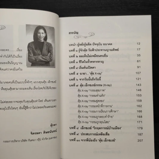 ตุ้ย X ray เอ็กซเรย์กรรม รูปที่ 6