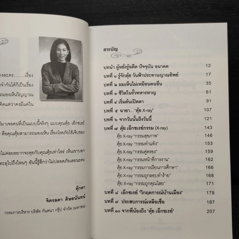 ตุ้ย X ray เอ็กซเรย์กรรม รูปที่ 6