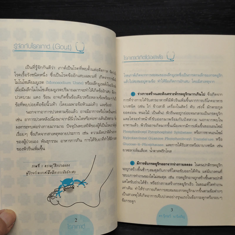 โรคเกาต์ - ดร.รุ้งระวี นาวีเจริญ รูปที่ 6