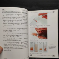 โลหิตวิทยา Hematology - สุภินันท์ สเป็ค-สายเชื้อ รูปที่ 7