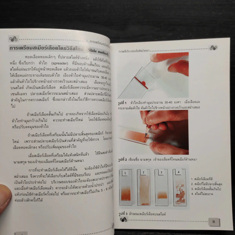 โลหิตวิทยา Hematology - สุภินันท์ สเป็ค-สายเชื้อ รูปที่ 7