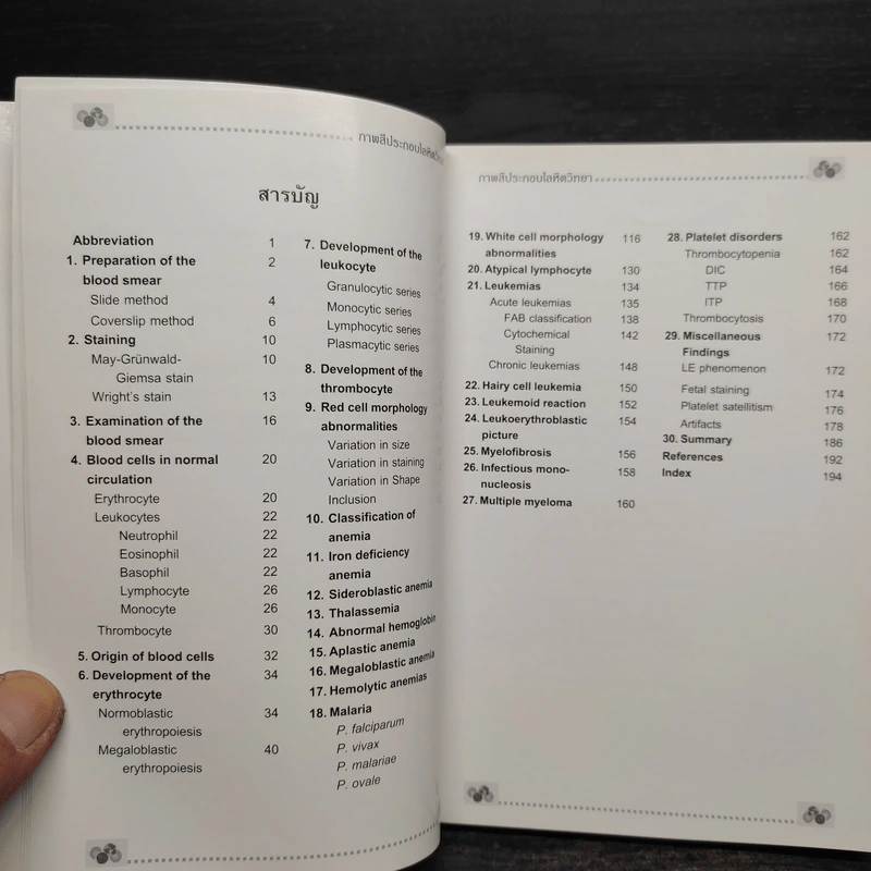 โลหิตวิทยา Hematology - สุภินันท์ สเป็ค-สายเชื้อ รูปที่ 6
