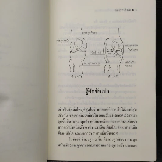 ข้อเข่าเสื่อม - มัณฑนา วงศ์ศิรินวรัตน์ รูปที่ 6