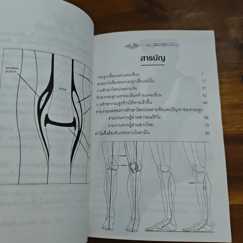 ปัญหาข้อกระดูก - พ.อ.หญิง ศรีนวล เจียจันทร์พงษ์ รูปที่ 7