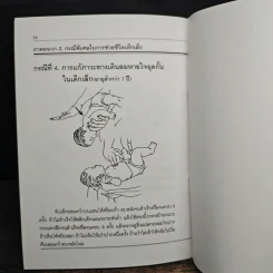 คู่มือการปฏิบัติการช่วยชีวิตขั้นพื้นฐาน รูปที่ 9