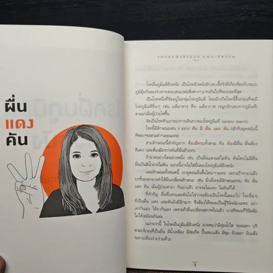โรคภูมิแพ้ ตอน ภูมิแพ้ผิวหนัง - แพทย์หญิงสิรินันท์ บุญยะลีพรรณ รูปที่ 8