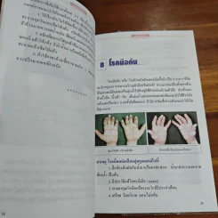รอบรู้เรื่องโรคผิวหนัง - นพ.สมบูรณ์ จิรโรจน์วัฒน รูปที่ 8