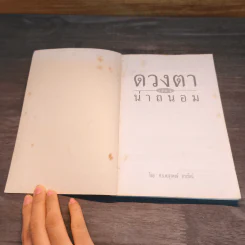 ดวงตาน่าถนอม เล่ม 1 - นพ.สุรพงษ์ ดวงรัตน์ รูปที่ 6