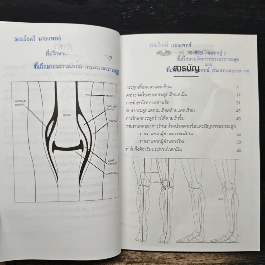 ปัญหาข้อกระดูก - พ.อ.หญิง ศรีนวล เจียจันทร์พงษ์ รูปที่ 7