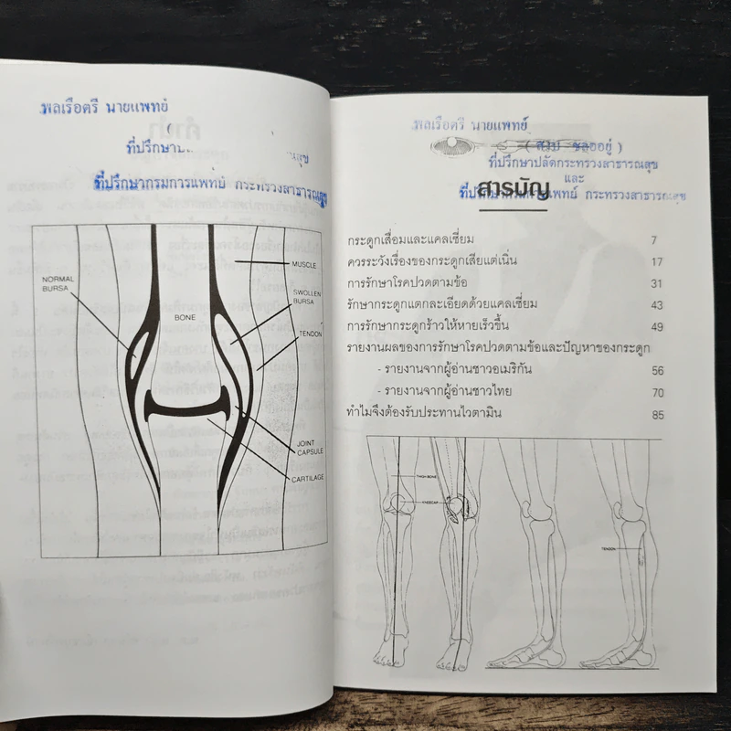 ปัญหาข้อกระดูก - พ.อ.หญิง ศรีนวล เจียจันทร์พงษ์ รูปที่ 7