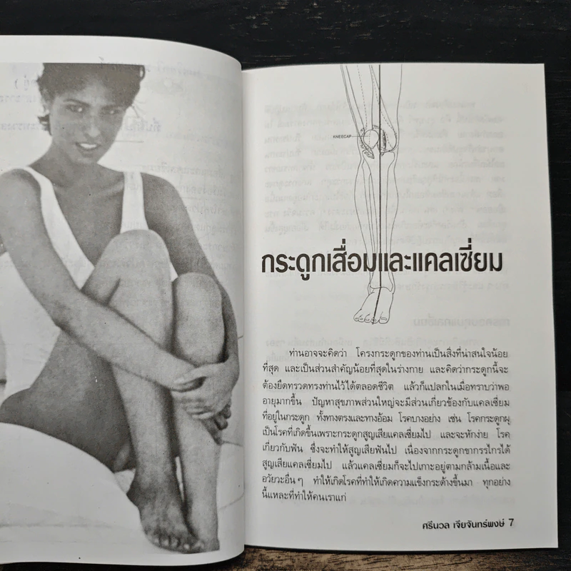 ปัญหาข้อกระดูก - พ.อ.หญิง ศรีนวล เจียจันทร์พงษ์ รูปที่ 8