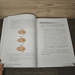 ความรู้พื้นฐานเพื่อการป้องกันและรักษาโรคสมองเสื่อม Alzheimer - วิภาวรรณ ตั้งนิพนธ์ รูปที่ 9