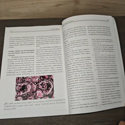Essentials of Glomerular Disease - บัญชา สถิระพจน์ รูปที่ 8